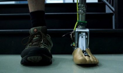 Akıllı prostetik bilek yüzeye göre kendini ayarlayabiliyor